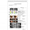 Dry Eye Analyzer (SL-6EB Slip Lamp)